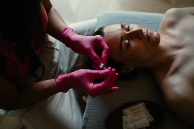 Igłoterapia Estetyczna i Pinezkowanie: Skuteczny Sposób na Młodszy Wygląd miniatura 2