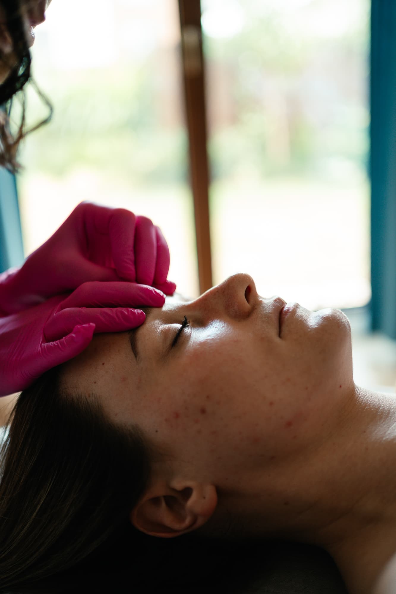 Igłoterapia Estetyczna i Pinezkowanie: Skuteczny Sposób na Młodszy Wygląd miniatura 7