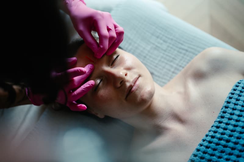 Igłoterapia Estetyczna i Pinezkowanie: Skuteczny Sposób na Młodszy Wygląd